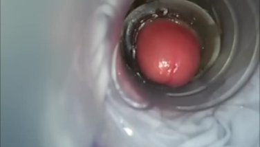 homemade pic real girls hair pussy the mom on gorge lopez nude